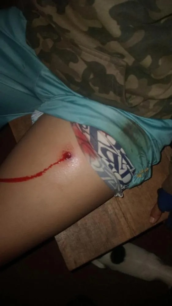 Quatro indígenas são baleados em Guaíra