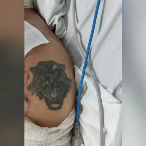 HUOP pede ajuda para identificar paciente com queimaduras graves. Ele seria morador de Marechal Rondon